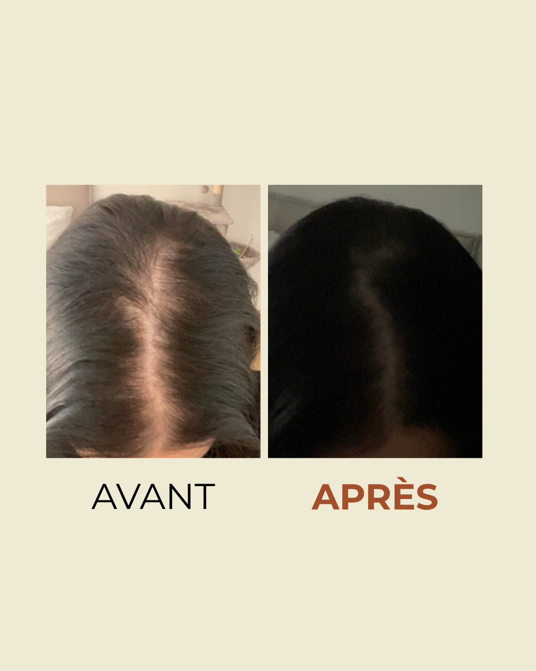 Offre Duo : A-Beauty Therapy