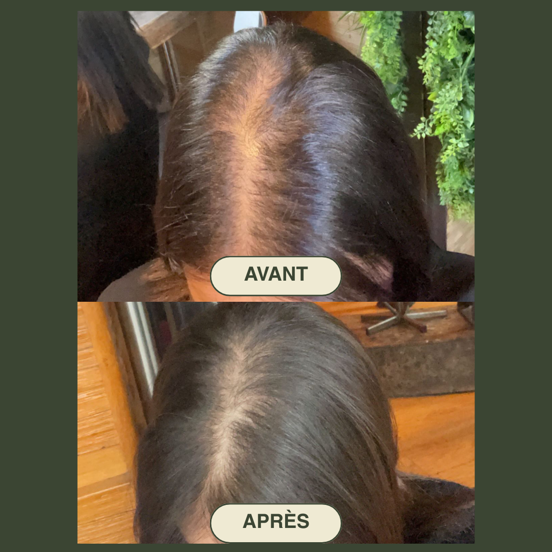 A-Beauty Therapy Ritual