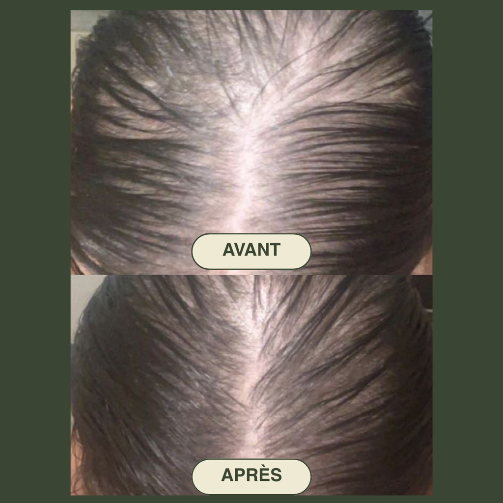 A-Beauty Therapy Ritual