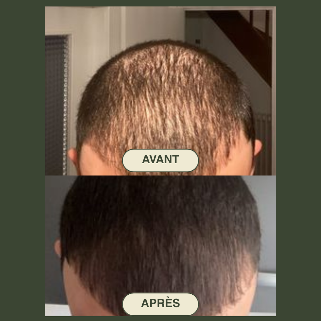 A-Beauty Therapy Ritual