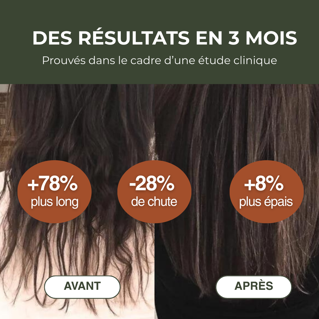 Protocole de Repousse