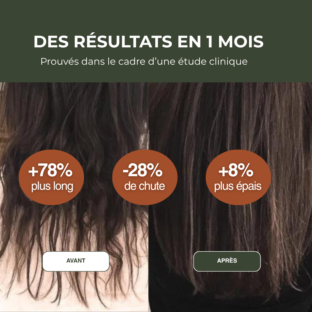 Protocole 3-en-1 + Huile Offerte : Stoppez la chute, relancez la pousse